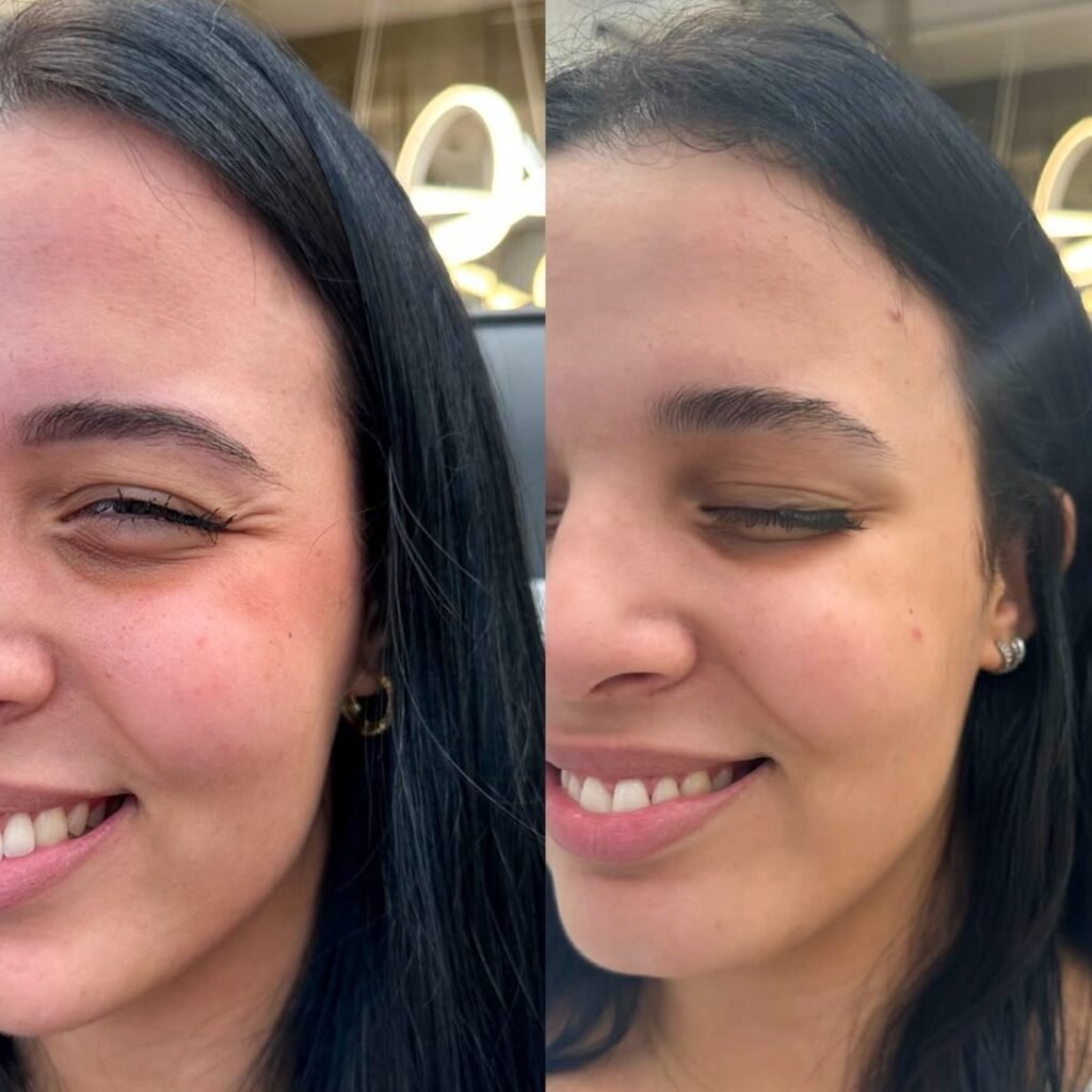 Antes e depois de harmonização facial na Leviss Odontologia