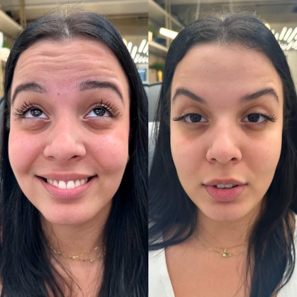 Antes e depois de harmonização facial na Leviss Odontologia